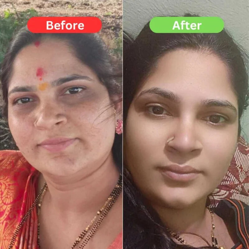 SPECIAL MAHA Pigmentation & Glow Skin Brighten Combo | Night Cream + Vitamin C Serum