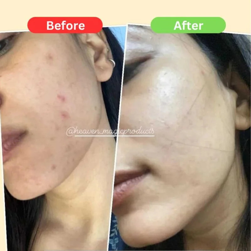 SPECIAL MAHA Pigmentation & Glow Skin Brighten Combo | Night Cream + Vitamin C Serum