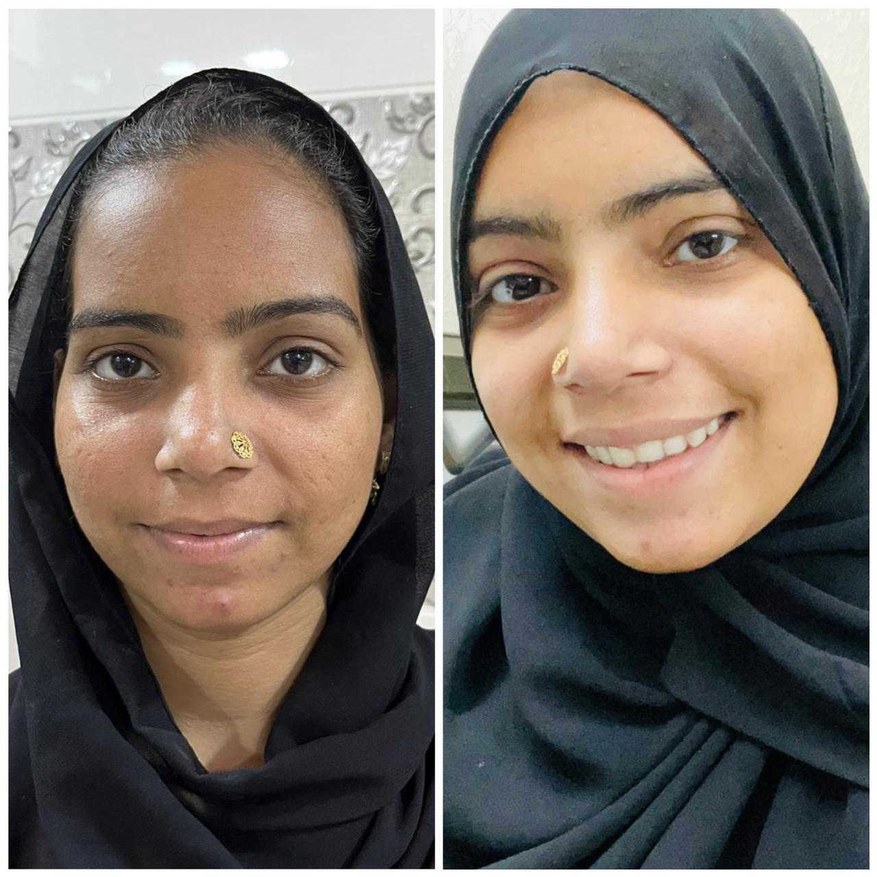 SPECIAL MAHA Pigmentation & Glow Skin Brighten Combo | Night Cream + Vitamin C Serum
