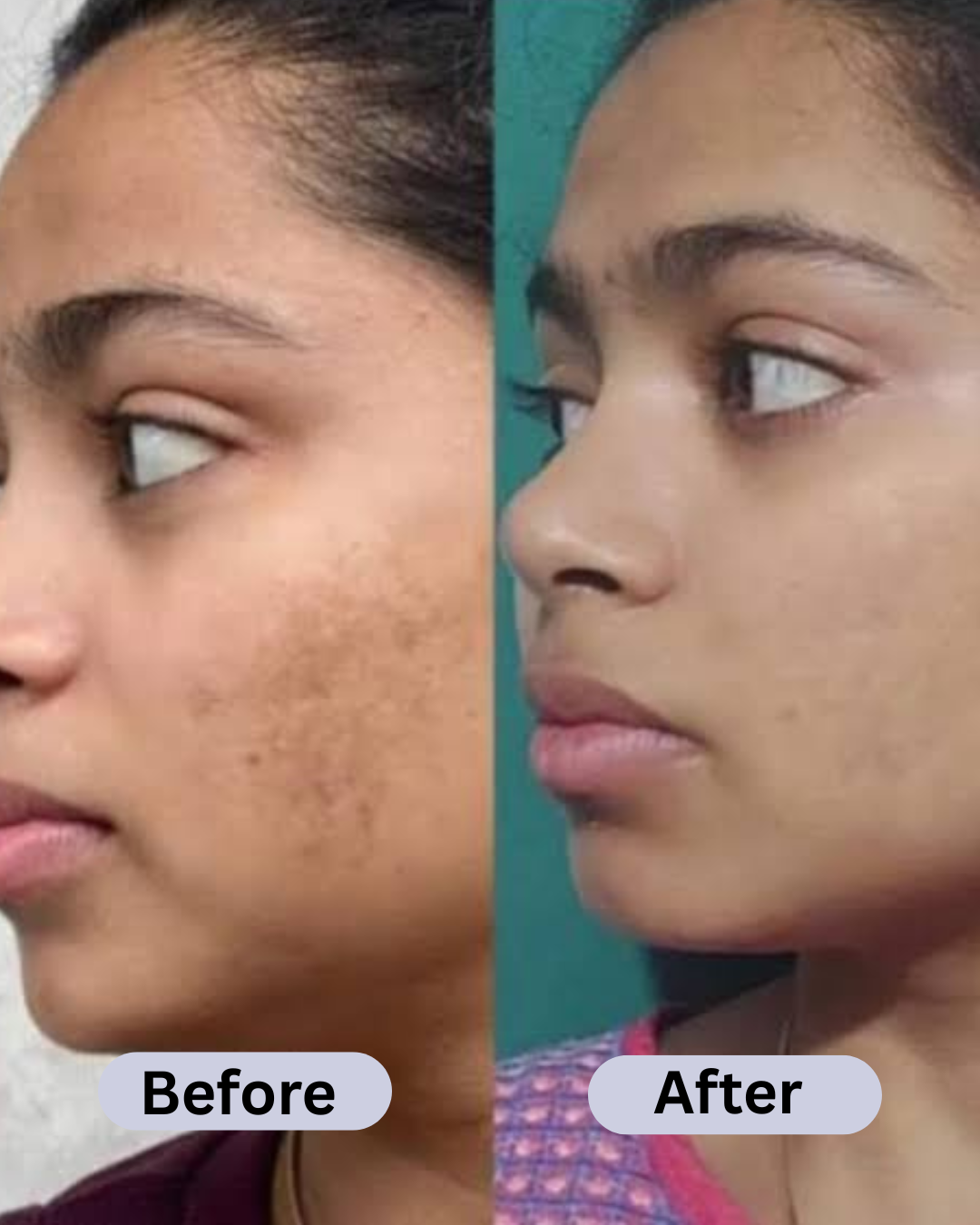 SPECIAL MAHA Pigmentation & Glow Skin Brighten Combo | Night Cream + Vitamin C Serum