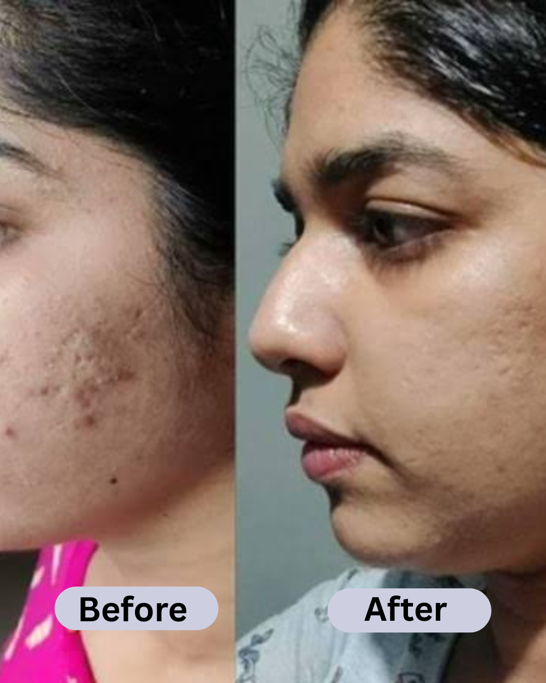 SPECIAL MAHA Pigmentation & Glow Skin Brighten Combo | Night Cream + Vitamin C Serum