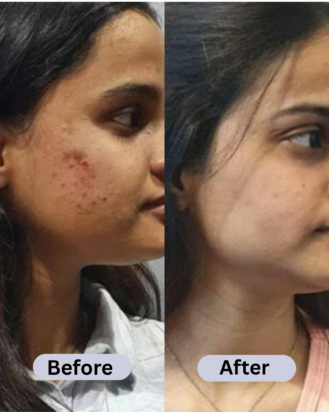 SPECIAL MAHA Pigmentation & Glow Skin Brighten Combo | Night Cream + Vitamin C Serum